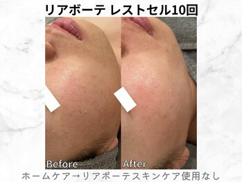 リライン(ReLine)/【レストセル 10回】