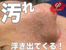 エピ(ep)