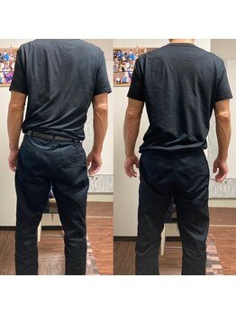 整体院りょう 高槻市/#側湾でお悩みの方