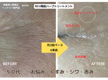 ポノ 甲府本店(pono)/REVI陶肌ハーブトリートメント