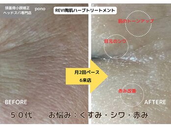 ポノ 甲府本店(pono)/REVI陶肌ハーブトリートメント