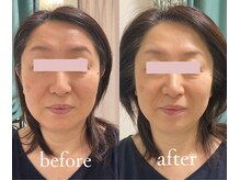 トリートメントルーム フェリーチェ(Felice)/頭皮とカラダケアで眉形まで変化