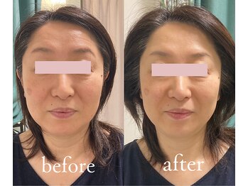 トリートメントルーム フェリーチェ(Felice)/頭皮とカラダケアで眉形まで変化