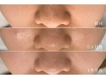 プラセル(Placer)の雰囲気（きれいになるのはもちろん♪悩みを繰り返さない健康な肌へ！！）