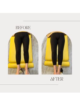 多摩 唐木田整体室/産後骨盤のビフォーアフター