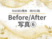 ナオル整体 西川口院(NAORU整体)/西川口 蕨 戸田 整体 骨盤矯正