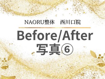 ナオル整体 西川口院(NAORU整体)/西川口 蕨 戸田 整体 骨盤矯正