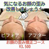 アノン 松山(Anon)