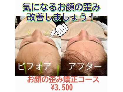 アノン 松山(Anon)の写真