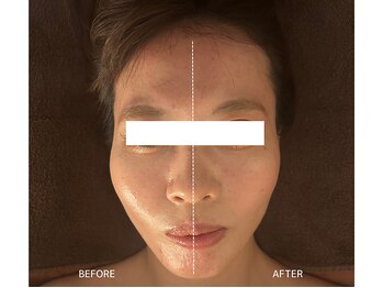 頭蓋骨 小顔矯正サロン グレースフィオーレ 札幌店(gracefiore)/ビフォーアフター