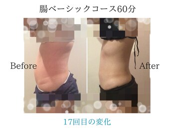 リープル(Leapl)/【痩身】腸もみ後の変化写真