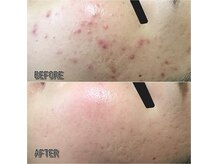 家ではできないケアはプロにお任せ☆違いを実感して下さい！