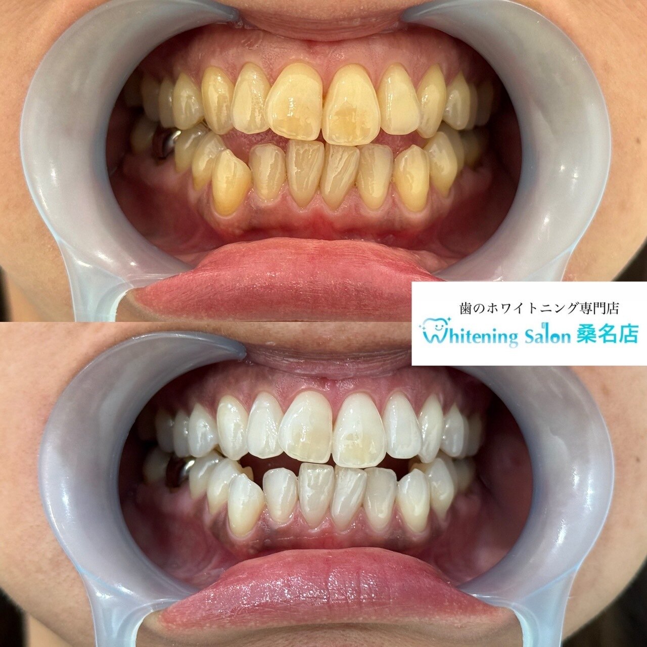 ホワイトニングサロン 三重県桑名店｜ホットペッパービューティー