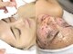 ルーナ 恵比寿(Luna)の写真/当店人気NO,1【毛穴洗浄×うる艶フェイスWAX】毛穴汚れ・黒ずみ・ザラつき解消♪最新韓国ピーリングも◎