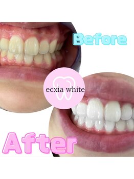 エクシアホワイト 倉吉店(ecxia white)/ビフォーアフター