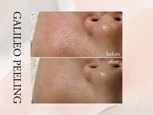ビシア(Bicia)/GALILEO PEELING