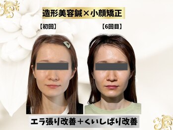 エモシオン トウキョウ(EMOTION TOKYO)/造形フェイス