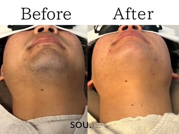 ソウ 越前店(sou.)/