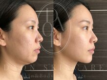 多穏スキンケア(skin care)/【人気No.1】ヴィショットV-shot