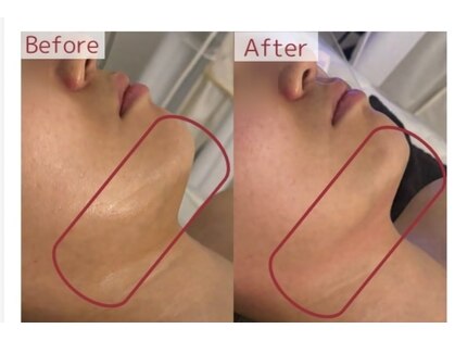 ラヴィエール(Laviere)の写真