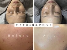 サロンナナジュウニ(Salon72)の雰囲気(即効性があり結果重視のサロンです☆)