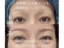 ヴィクトリア アイ(victoriaeye)