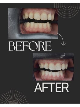 セルフダック 栃木小山店(SELFDUCK)/50代 女性