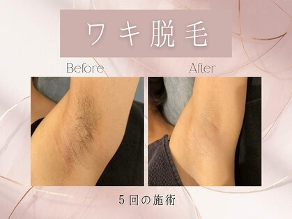 ルミナ(lumina.)の写真