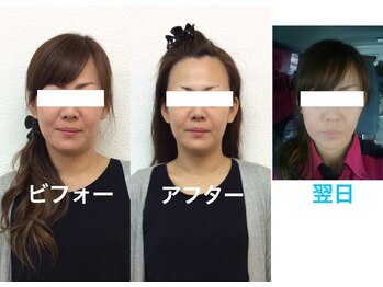 ビューティスタジオＫ/小顔矯正ビフォーアフター
