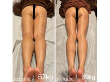 スピード美人 本八幡店の雰囲気（筋肉質な足も女性らしく痩せれます。）