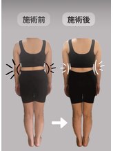 アイヲン(Aiwon)/【むくみ】【ダイエット】