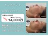 【初回限定クチコミ割】脂肪減少オンダリフト◆70KJ＋LDM  ¥20,000→¥14,000 