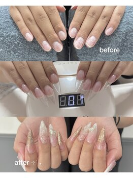 ニーヨンネイル(24nail)/スカルプ＊ビフォーアフター