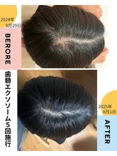 ワンダー(Wonder)/気になった時が、始め時です！