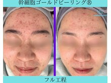 リメイク 広尾(REMAKE)/