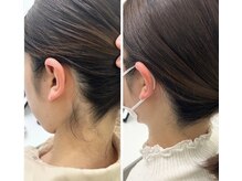 ミース 久留米店/うなじ脱毛体験1回目！