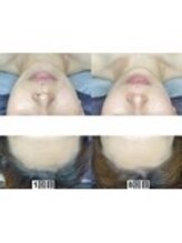 アンドミー 鹿児島中山(&me)/ララピール【艶肌/美白/くすみ】