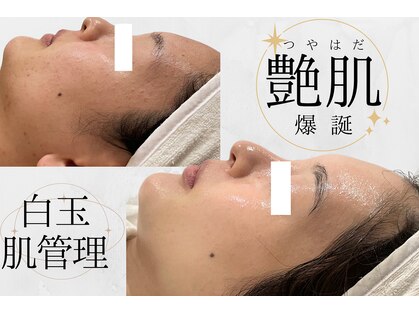 リーズリアン(Rises Lien)の写真