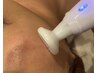 【人気No.1☆肌質改善】刺さないダーマ”プラズマニア”で水光肌&ニキビ改善
