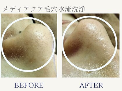 サロン ピューパ(Salon pupa)の写真