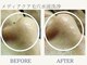 サロン ピューパ(Salon pupa)の写真