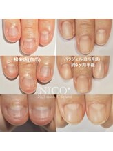 ニコプラス(NICO+)/深爪育成パラジェルクリア補強