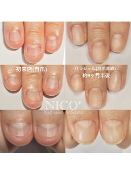 ニコプラス(NICO+)/深爪育成パラジェルクリア補強