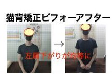 やち鍼灸院/姿勢を良くして腰痛、膝痛予防に