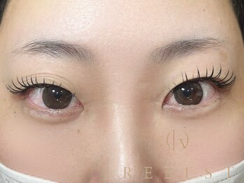 リーベスト 心斎橋(REBEST)/バインドロック