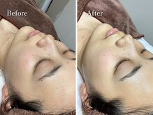 エリー(Ellie)/ツヤっと明るい肌に☆