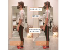 サンテリア(Santelia)の雰囲気（猫背/反り腰/O脚/骨盤など姿勢のお悩みも♪）