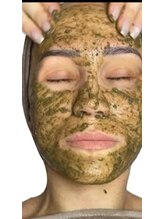 サロンハル(salon HARU)/剥離あり、ハーブピーリング