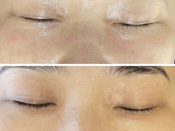 ラヴィ(Ravi)/目元ケア