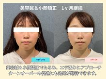 晴々